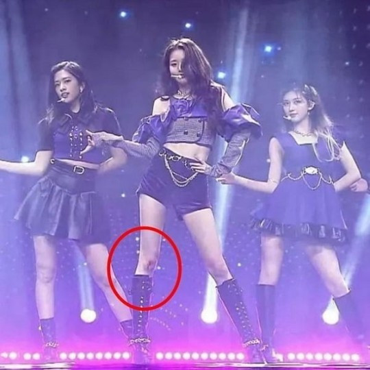 'Top Idols' Show Professional Spirit Despite Injuries: From Jang Wonyoung to Blackpink Jennie 'Top Idols' Show Professional Spirit Despite Injuries: From Jang Wonyoung to Blackpink Jennie